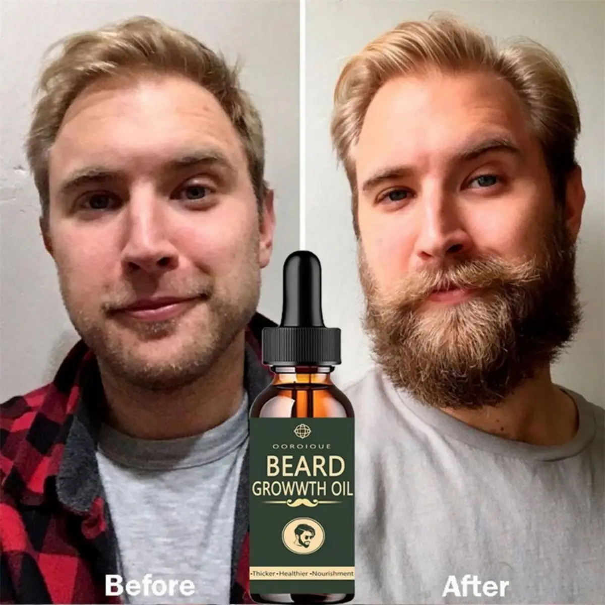 Hair Care Essence Oil Spray - Fast Beard Growth Oil Beard Oil