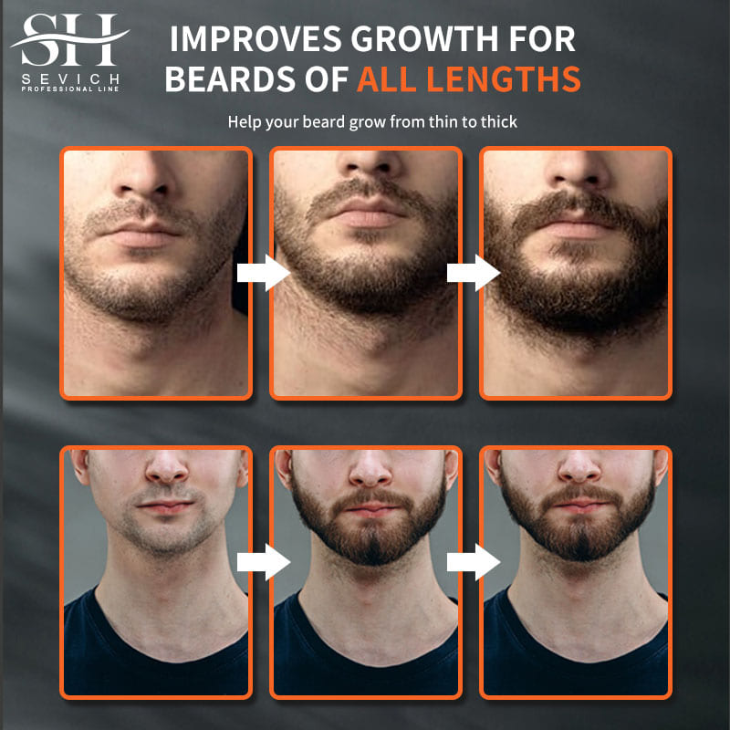 Sevich Men Beard Growth Essent - đánh giá và giá Hair Care Serum