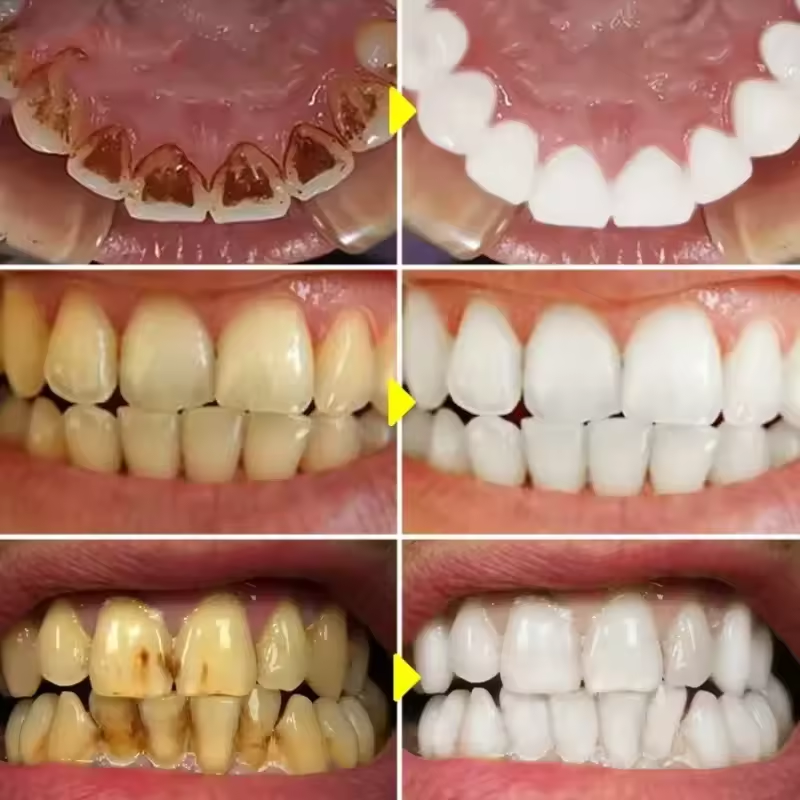 V34 Teeth Whitening Purple Too - đánh giá và giá Purple Toning Shampoo