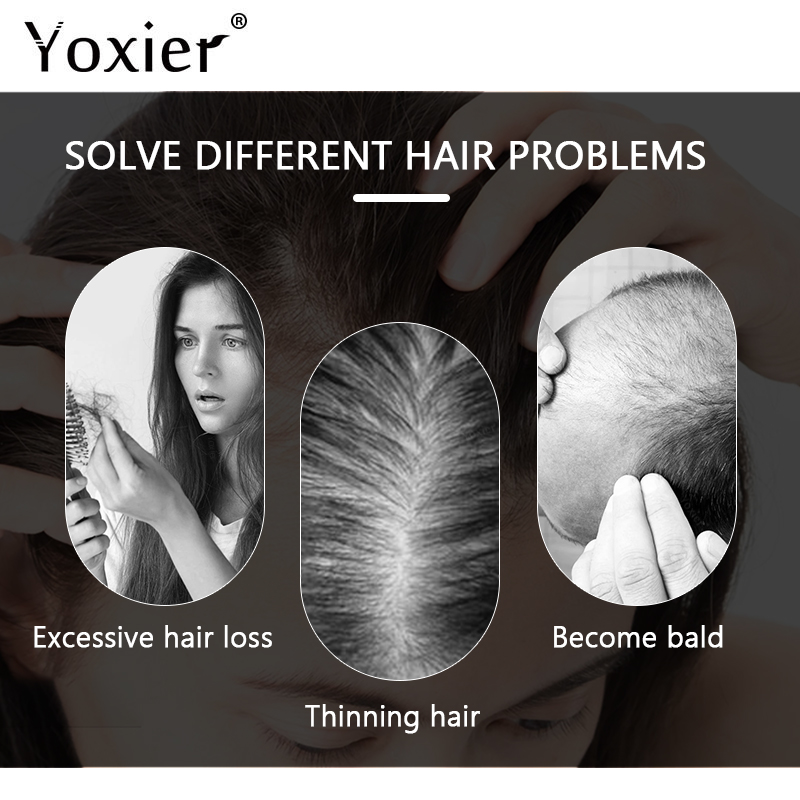 Intensive Growth Serum Prevent - đánh giá và giá Hair Care Serum