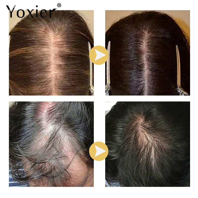 Intensive Growth Serum Prevent - đánh giá và giá Hair Care Serum