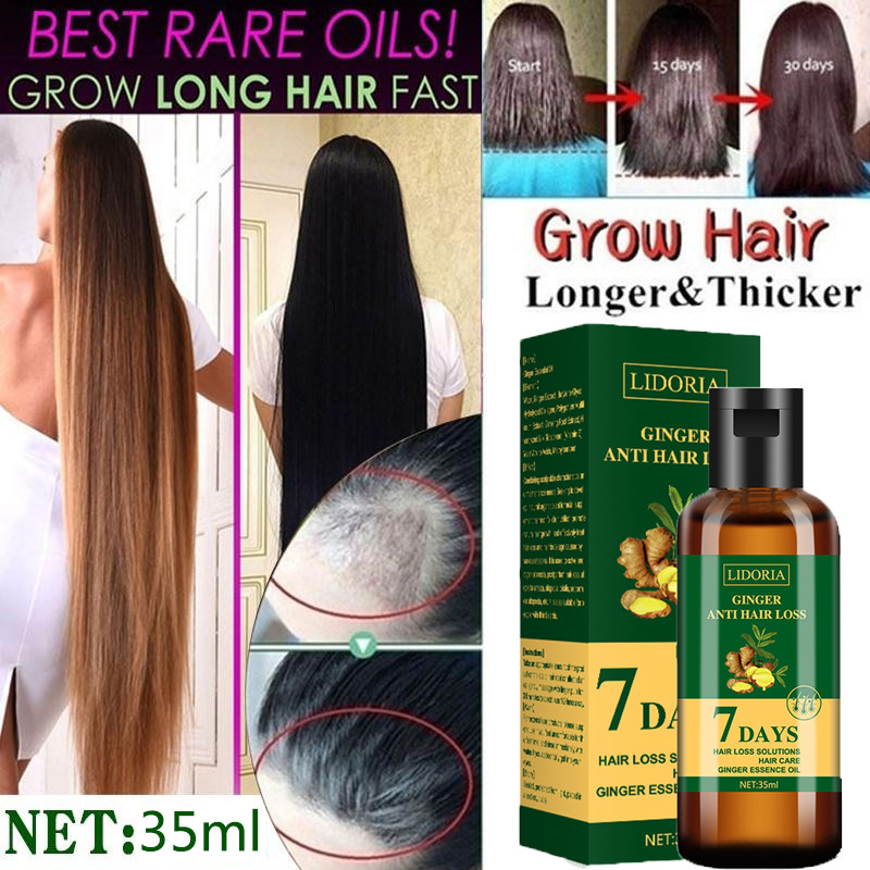 Ginger Hair Growth Essential O - đánh giá và giá Hair Care Essence Oil Spray