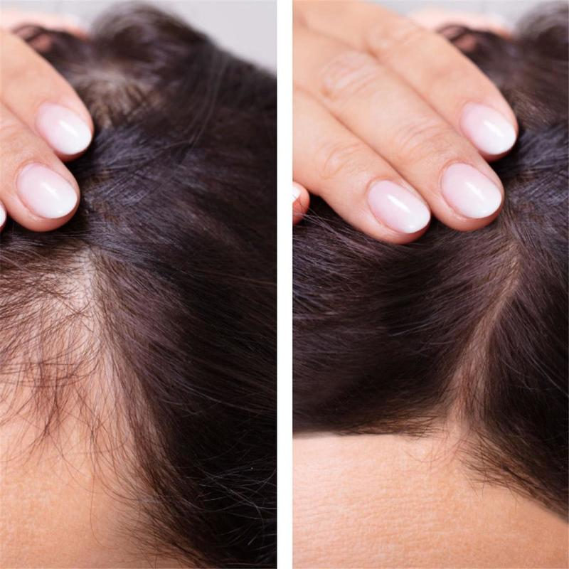 Ginger Hair Growth Essential O - đánh giá và giá Hair Care Essence Oil Spray