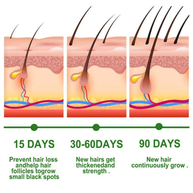 Hair Growth Serum Fast Growing - đánh giá và giá Hair Care Essence Oil Spray