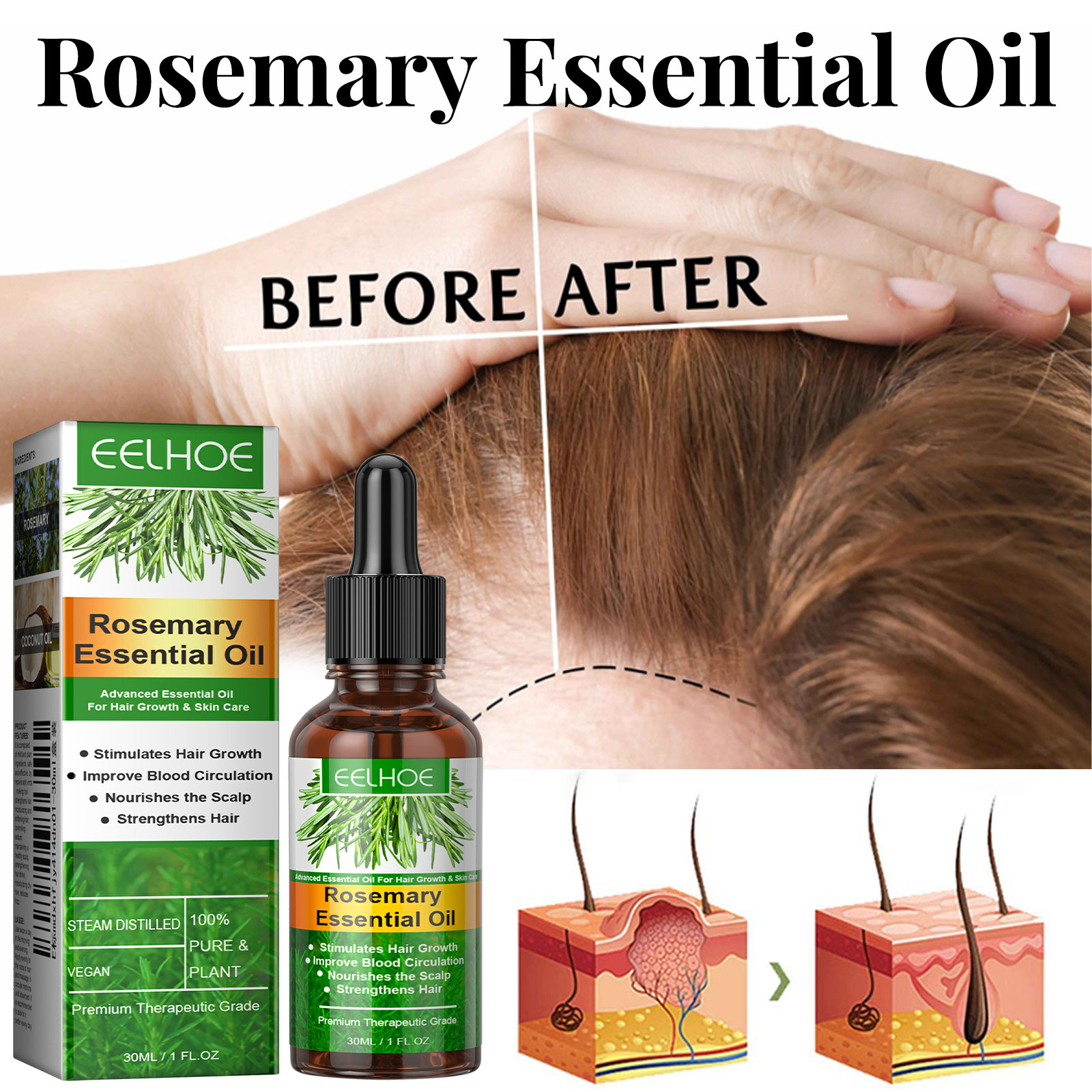 Hair Growth Serum Fast Growing - đánh giá và giá Hair Care Essence Oil Spray