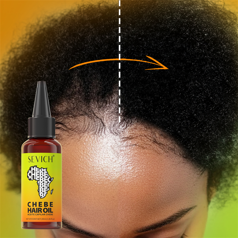 Chebe Fast Hair Growth Oil Afr - đánh giá và giá Hair Care Essence Oil Spray