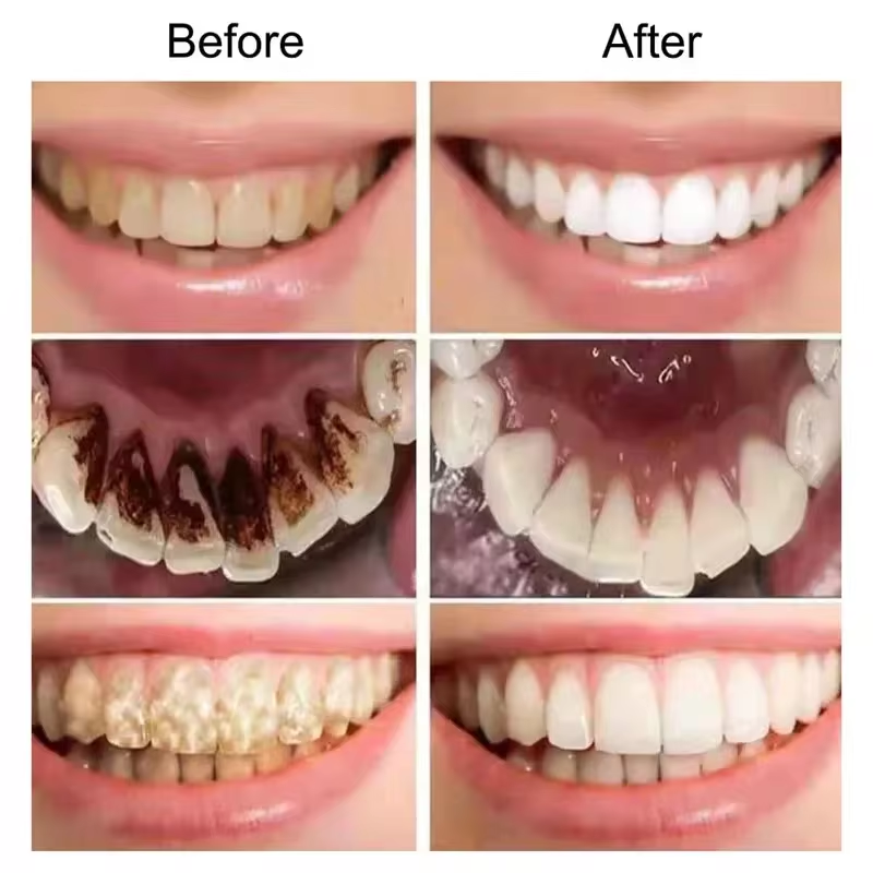 V34 Purple Teeth Whitening Too - đánh giá và giá Purple Toning Shampoo
