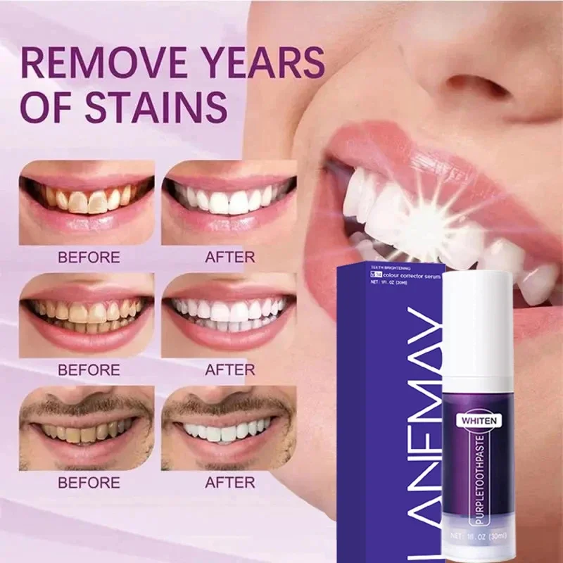 V34 Purple Teeth Whitening Too - đánh giá và giá Purple Toning Shampoo