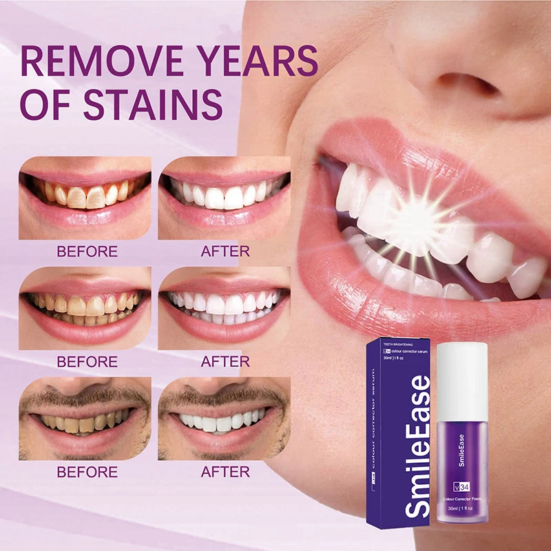 45ml Smilekit Purple Tooth Mou - đánh giá và giá Purple Toning Shampoo