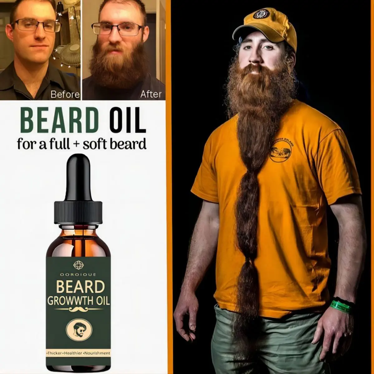 Fast Beard Growth Oil Beard Oi - đánh giá và giá Hair Care Essence Oil Spray