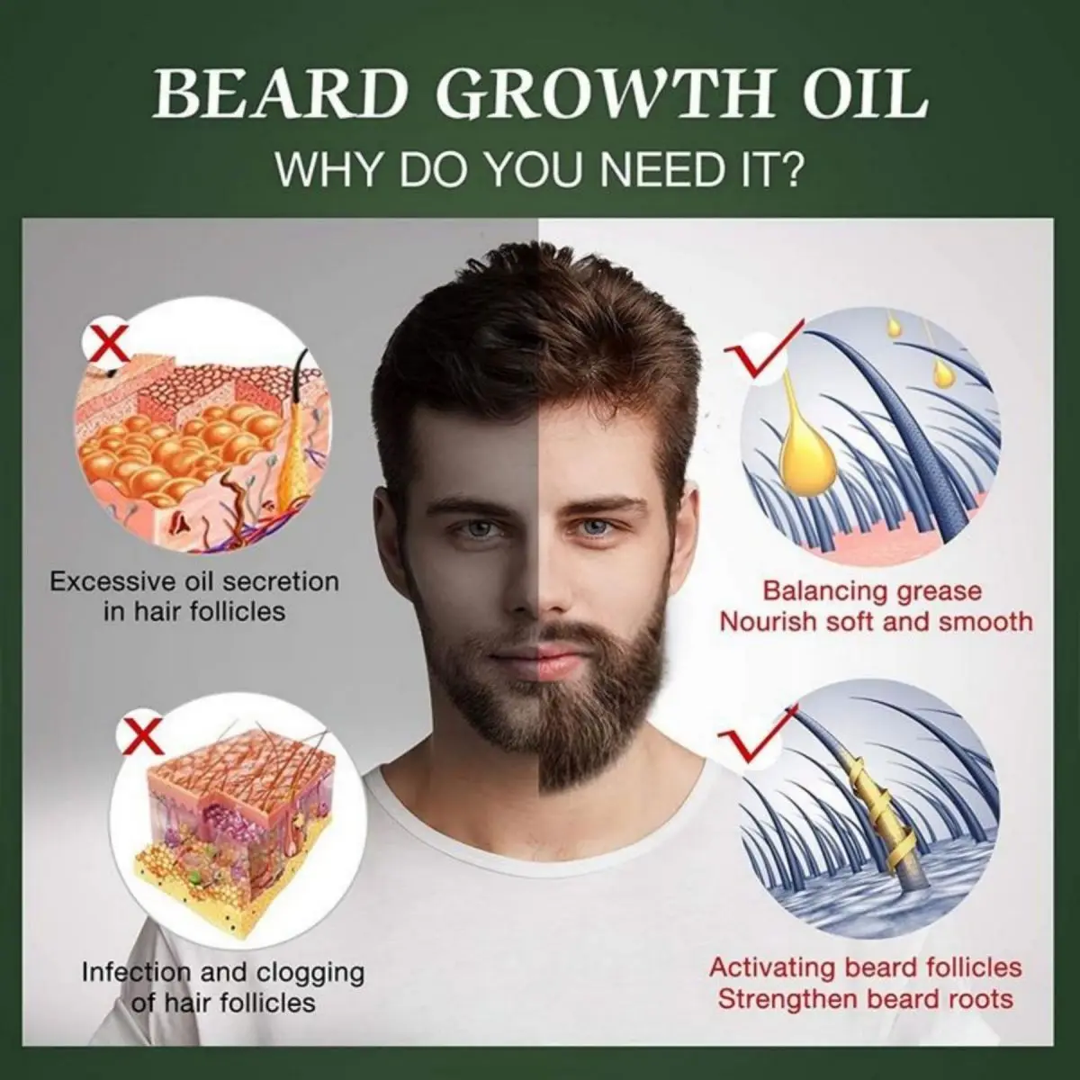 Fast Beard Growth Oil Beard Oi - đánh giá và giá Hair Care Essence Oil Spray