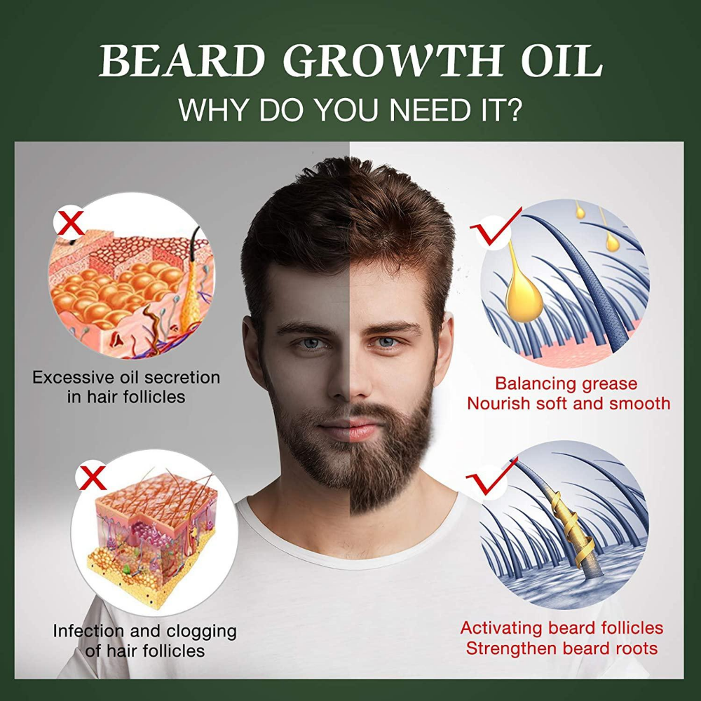 Fast Beard Growth Oil Beard Oi - đánh giá và giá Hair Care Essence Oil Spray