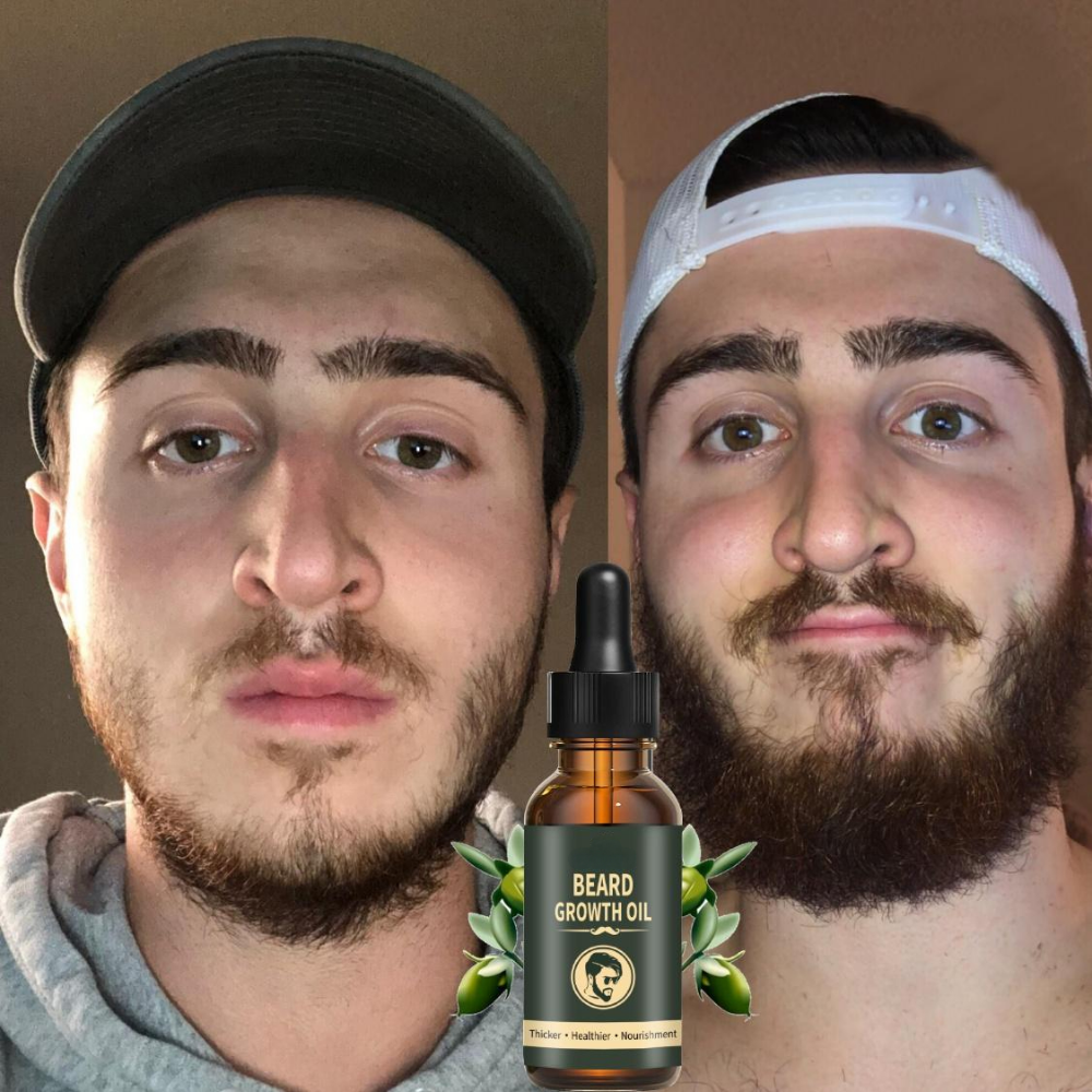 Fast Beard Growth Oil Beard Oi - đánh giá và giá Hair Care Essence Oil Spray