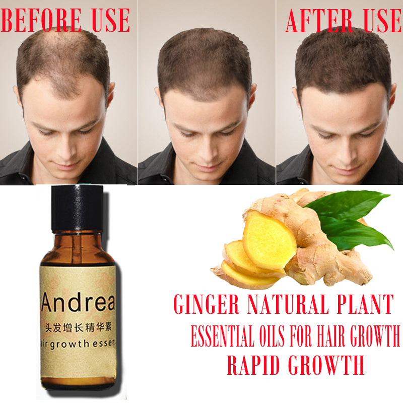 2/5/10Pcs Andrea Hair Growth S - đánh giá và giá Hair Care Essence Oil Spray