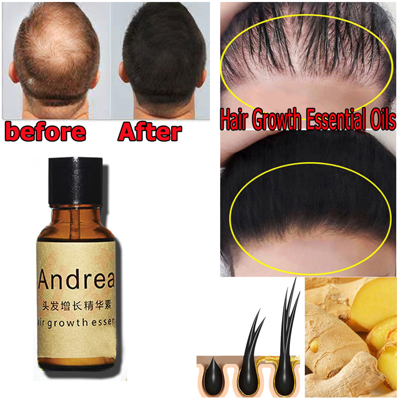 2/5/10Pcs Andrea Hair Growth S - đánh giá và giá Hair Care Essence Oil Spray